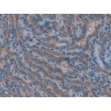 Collagen Type IV Alpha 1 (COL4a1) Human Polyclonal Antibody