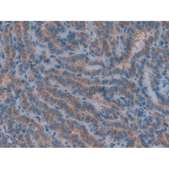 Collagen Type IV Alpha 1 (COL4a1) Human Polyclonal Antibody