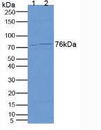 Carcinoembryonic Antigen (CEA) Human Polyclonal Antibody
