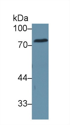 Carcinoembryonic Antigen (CEA) Human Polyclonal Antibody