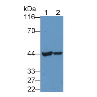 Carcinoembryonic Antigen (CEA) Human Polyclonal Antibody