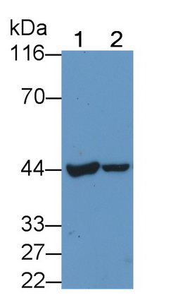 Carcinoembryonic Antigen (CEA) Human Polyclonal Antibody