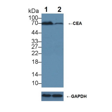 Carcinoembryonic Antigen (CEA) Human Polyclonal Antibody