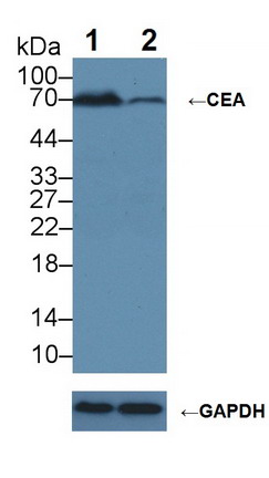 Carcinoembryonic Antigen (CEA) Human Polyclonal Antibody