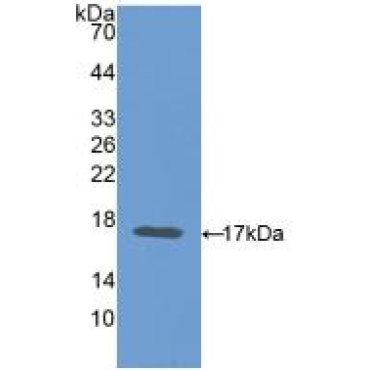 Carcinoembryonic Antigen (CEA) Mouse Polyclonal Antibody