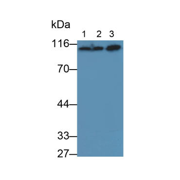 Carcinoembryonic Antigen (CEA) Mouse Polyclonal Antibody