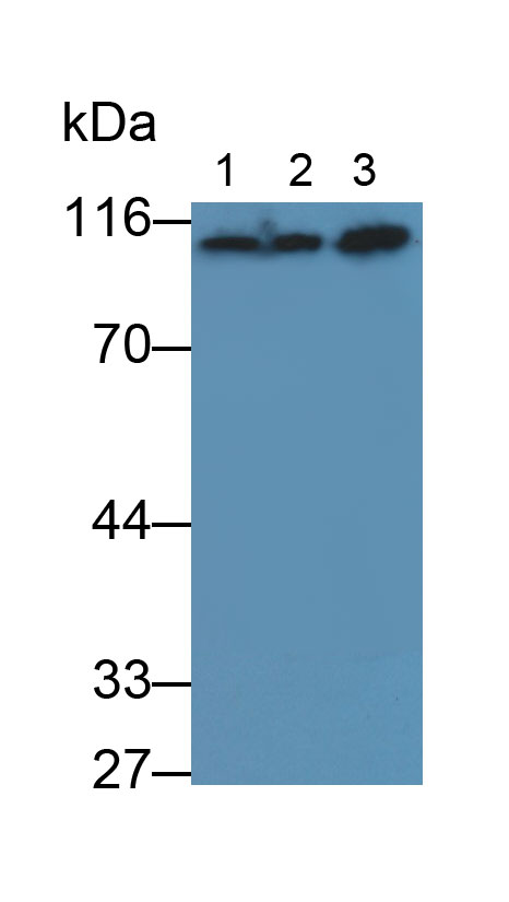 Carcinoembryonic Antigen (CEA) Mouse Polyclonal Antibody