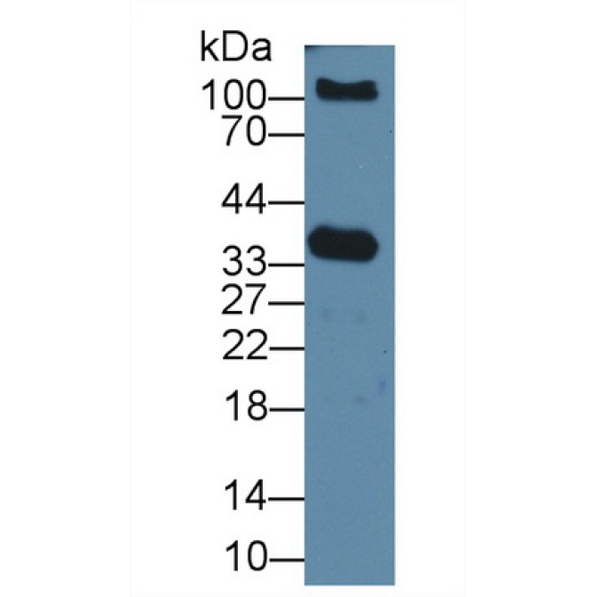 Prostate Specific Antigen (PSA) Human Polyclonal Antibody