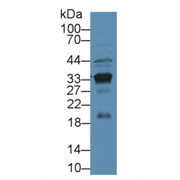 Prostate Specific Antigen (PSA) Mouse Polyclonal Antibody