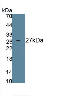 Prostate Specific Antigen (PSA) Rat Polyclonal Antibody