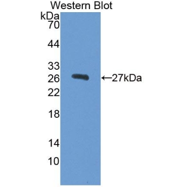 Alpha-Fetoprotein (AFP) Human Polyclonal Antibody