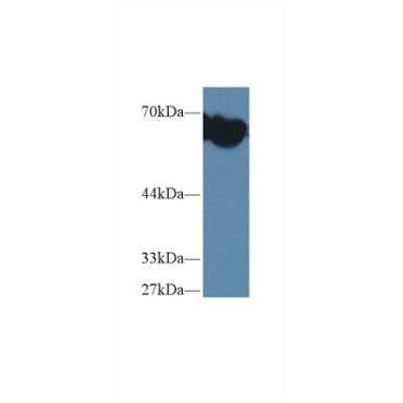 Alpha-Fetoprotein (AFP) Mouse Polyclonal Antibody