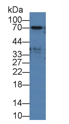 Alpha-Fetoprotein (AFP) Pig Polyclonal Antibody