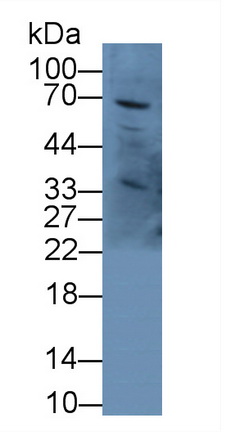 Alpha-Fetoprotein (AFP) Pig Polyclonal Antibody