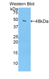 Alpha-Fetoprotein (AFP) Pig Polyclonal Antibody