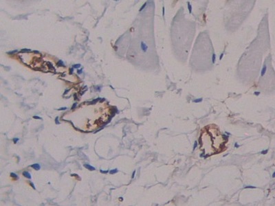 Alpha-Fetoprotein (AFP) Rat Polyclonal Antibody