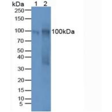 Carbohydrate Antigen 125 (CA125) Mouse Polyclonal Antibody
