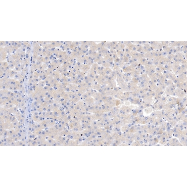 Serpin Peptidase Inhibitor,Clade B,Member 4 (SERPINB4) Human Polyclonal Antibody