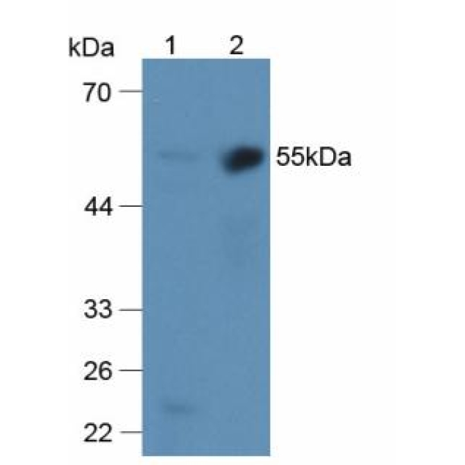 Alpha 2-Antiplasmin (a2PI) Human Polyclonal Antibody