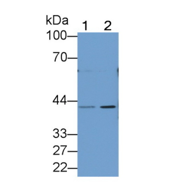 Pepsinogen A (PGA) Human Polyclonal Antibody