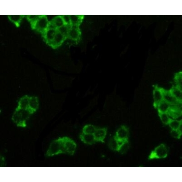 Prostatic Acid Phosphatase (PAP) Human Polyclonal Antibody