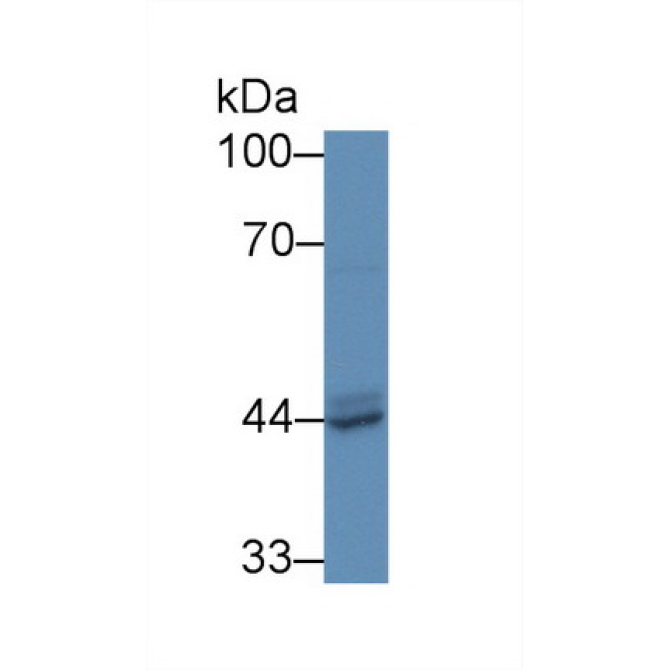 Prostatic Acid Phosphatase (PAP) Mouse Polyclonal Antibody