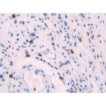 Platelet Factor 4 (PF4) Human Polyclonal Antibody