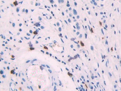 Platelet Factor 4 (PF4) Human Polyclonal Antibody