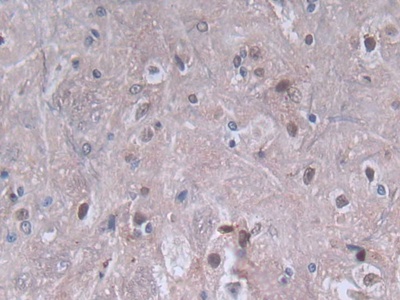 Platelet Factor 4 (PF4) Rat Polyclonal Antibody