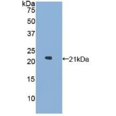 Glucosidase Alpha, Acid (GaA) Human Polyclonal Antibody