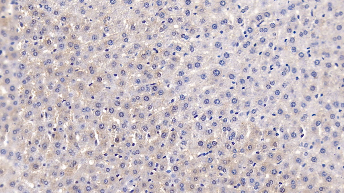 Glucosidase Alpha, Acid (GaA) Rat Polyclonal Antibody