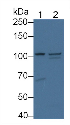 Glucosidase Alpha, Acid (GaA) Rat Polyclonal Antibody