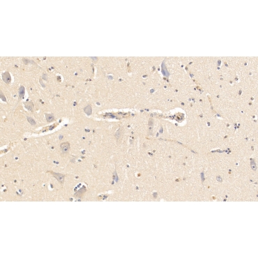Alpha-2-Heremans Schmid Glycoprotein (AHSG) Bovine (Cattle) Polyclonal Antibody