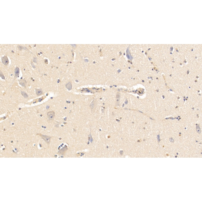 Alpha-2-Heremans Schmid Glycoprotein (AHSG) Bovine (Cattle) Polyclonal Antibody