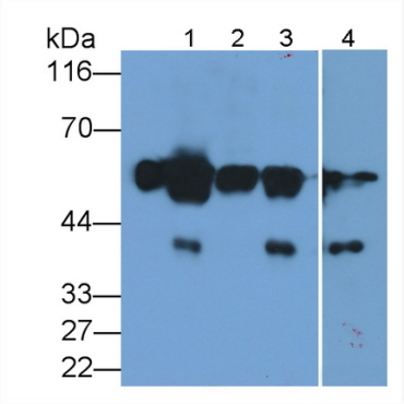 Alpha-2-Heremans Schmid Glycoprotein (AHSG) Human Polyclonal Antibody