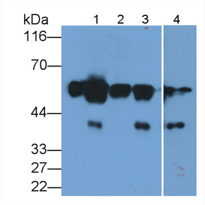 Alpha-2-Heremans Schmid Glycoprotein (AHSG) Human Polyclonal Antibody