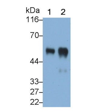 Alpha-2-Heremans Schmid Glycoprotein (AHSG) Human Polyclonal Antibody