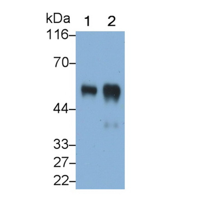 Alpha-2-Heremans Schmid Glycoprotein (AHSG) Human Polyclonal Antibody