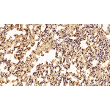 Interferon Alpha 2 (IFNa2) Human Polyclonal Antibody