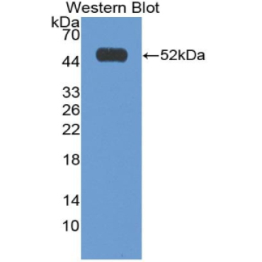 Interferon Alpha 2 (IFNa2) Human Polyclonal Antibody