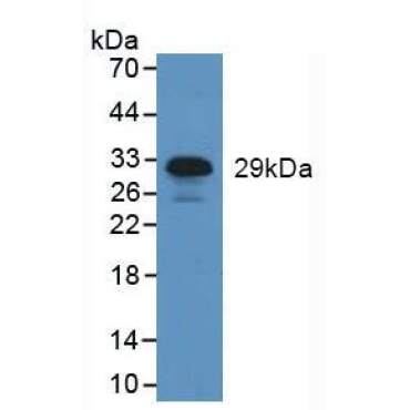 Neutrophil Elastase (NE) Human Polyclonal Antibody