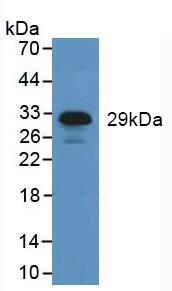 Neutrophil Elastase (NE) Human Polyclonal Antibody