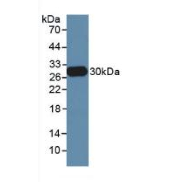Neutrophil Elastase (NE) Mouse Polyclonal Antibody