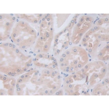 Galactosidase Alpha (GLa) Human Polyclonal Antibody