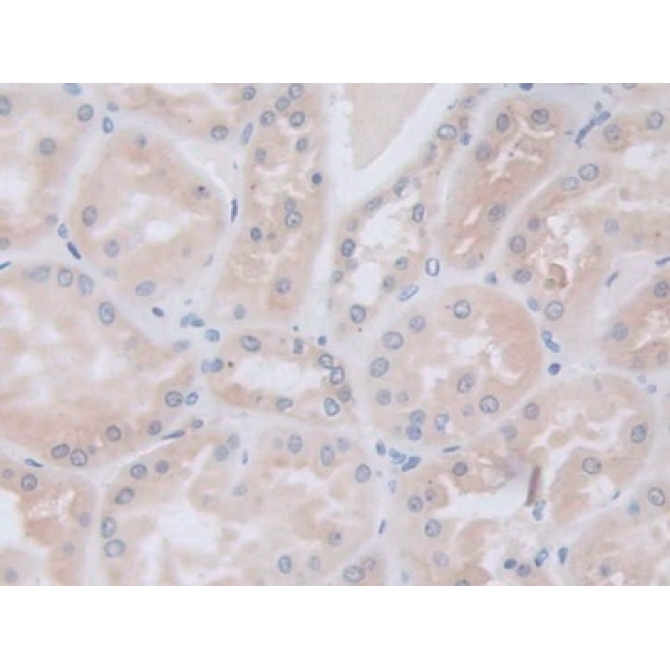 Galactosidase Alpha (GLa) Human Polyclonal Antibody