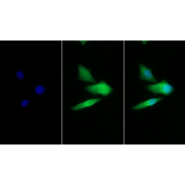 Galactosidase Alpha (GLa) Human Polyclonal Antibody
