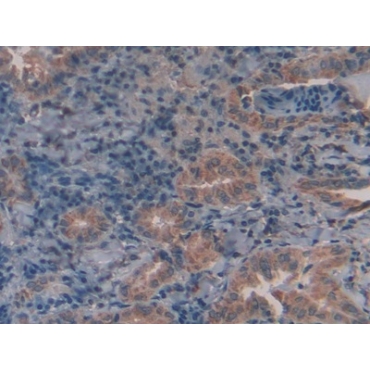 Galactosidase Alpha (GLa) Human Polyclonal Antibody