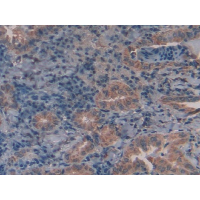 Galactosidase Alpha (GLa) Human Polyclonal Antibody