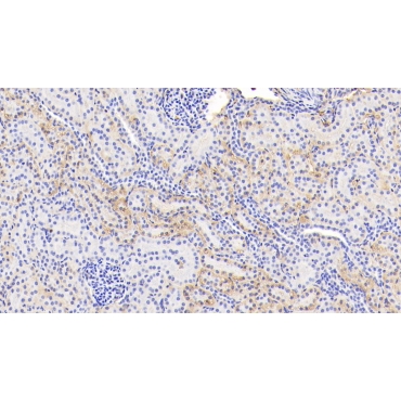 Glycated Hemoglobin A1c (HbA1c) Human Polyclonal Antibody