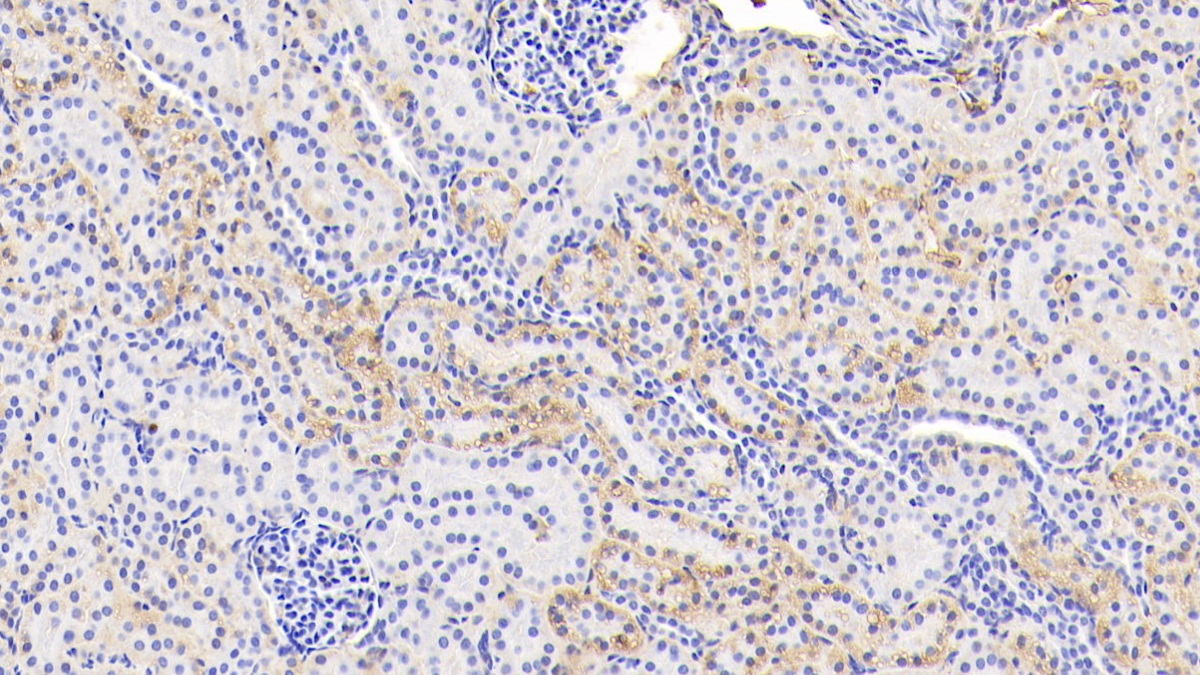 Glycated Hemoglobin A1c (HbA1c) Human Polyclonal Antibody